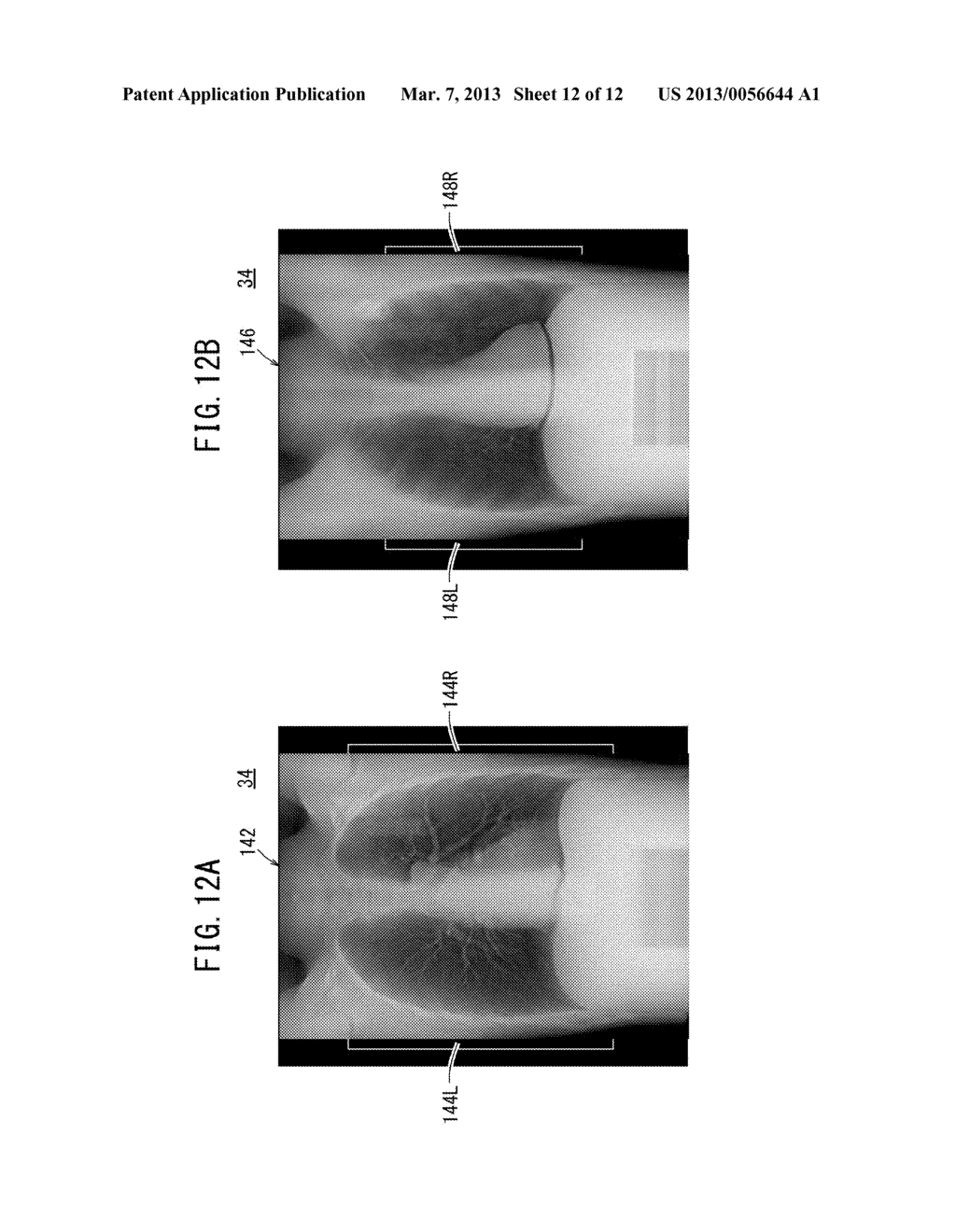 TOMOGRAPHIC IMAGE GENERATING APPARATUS AND TOMOGRAPHIC IMAGE GENERATING     METHOD - diagram, schematic, and image 13