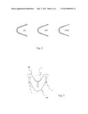 METHOD AND DEVICE FOR PRODUCING SEALING RINGS diagram and image