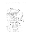 Pulsed Water-Jet Apparatus diagram and image