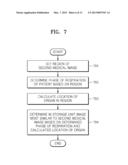 METHOD AND APPARATUS FOR GENERATING AN IMAGE OF AN ORGAN diagram and image