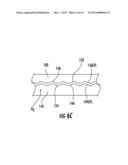 REMOVABLE STRAIN RELIEF BRACKETS FOR SECURING FIBER OPTIC CABLES AND/OR     OPTICAL FIBERS TO FIBER OPTIC EQUIPMENT, AND RELATED ASSEMBLIES AND     METHODS diagram and image