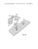 4-Protein Biomarker Panel for the Diagnosis of Lymphoma from Biospecimen diagram and image