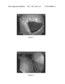 SOLID COMPOSITION FOR THE ORAL ADMINISTRATION OF DYES AND DIAGNOSTIC USE     THEREOF diagram and image