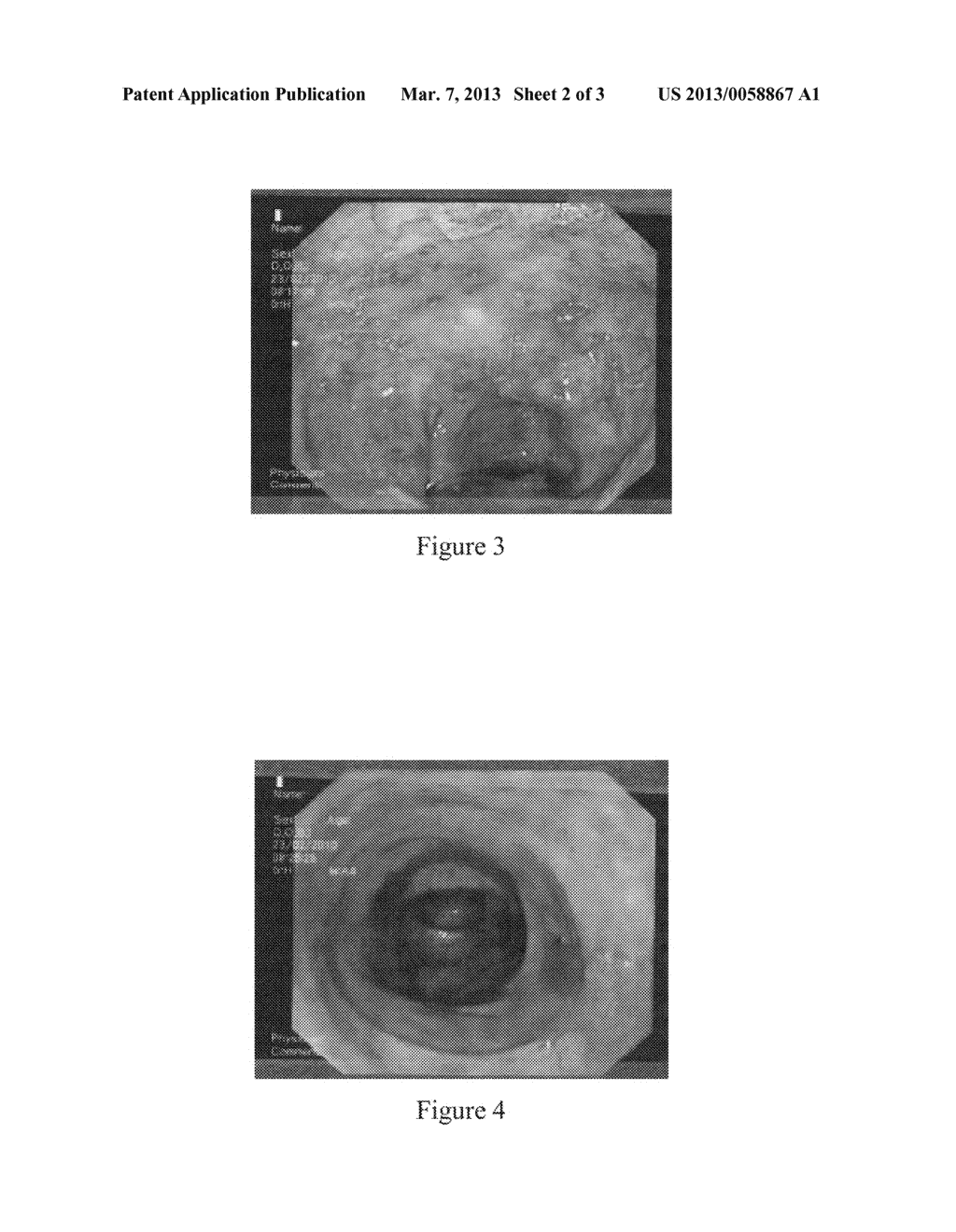 SOLID COMPOSITION FOR THE ORAL ADMINISTRATION OF DYES AND DIAGNOSTIC USE     THEREOF - diagram, schematic, and image 03