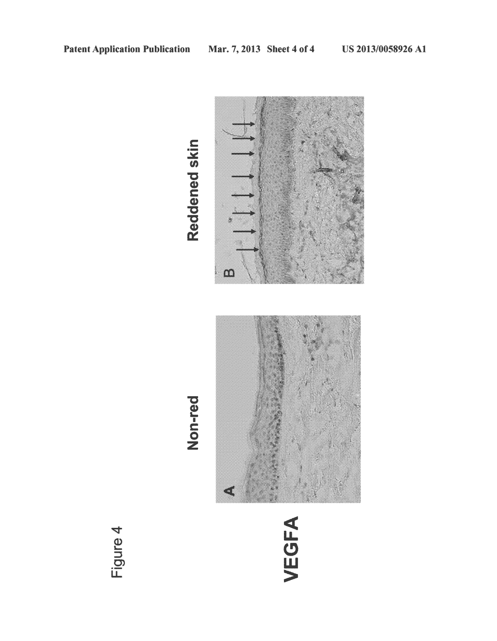 METHOD FOR ALLEVIATING AND/OR PREVENTING SKIN REDDENING - diagram, schematic, and image 05