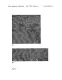 DIAGNOSTIC AND THERAPEUTIC METHODS FOR CORNEAL ECTASIA FOLLOWING     REFRACTIVE SURGERY, KERATOCONUS OR PELLUCID DEGENERATION diagram and image