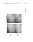 EXTRACELLULAR IFI16 AS THERAPEUTIC AGENTS diagram and image