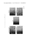 EXTRACELLULAR IFI16 AS THERAPEUTIC AGENTS diagram and image