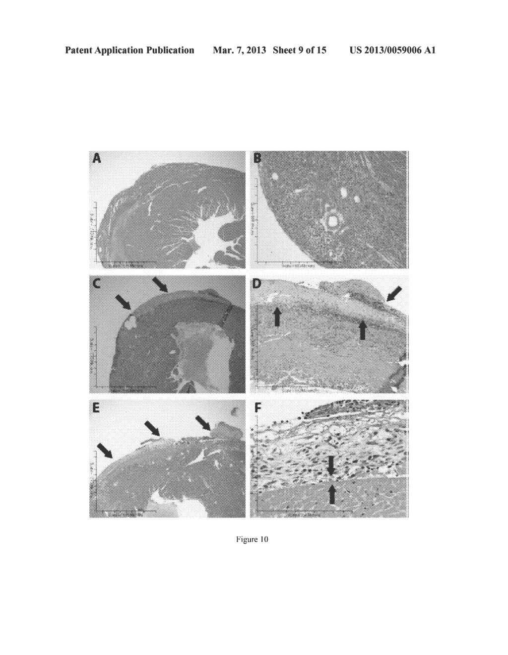 3-DIMENSIONAL CARDIAC FIBROBLAST DERIVED EXTRACELLULAR MATRIX - diagram, schematic, and image 10