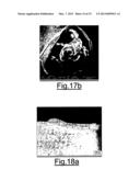 INJECTABLE OSTEOINDUCTIVE BONE CEMENTS diagram and image