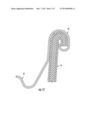 Retort Container With Thermally Fused Double-Seamed or Crimp-Seamed Metal     End diagram and image