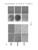 ENDOMETRIAL POLYP STEM CELL diagram and image