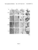 Novel Gene Targets Associated with Amyotrophic Lateral Sclerosis and     Methods of Use Thereof diagram and image