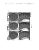 Novel Gene Targets Associated with Amyotrophic Lateral Sclerosis and     Methods of Use Thereof diagram and image