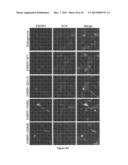 Novel Gene Targets Associated with Amyotrophic Lateral Sclerosis and     Methods of Use Thereof diagram and image