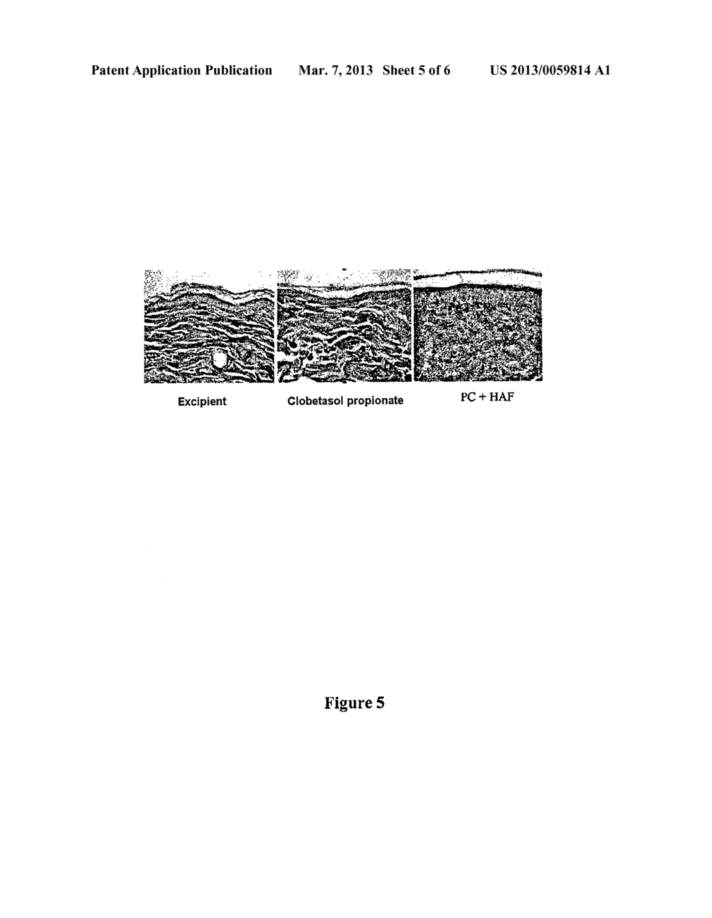 ANTI-INFLAMMATORY DERMATOLOGICAL COMPOSITION COMPRISING CORTICOSTEROIDS     AND HYALURONATE FRAGMENTS, AND USES THEREOF - diagram, schematic, and image 06