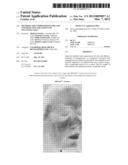 METHODS AND COMPOSITIONS FOR SAFE AND EFFECTIVE TREATMENT OF     TELANGIECTASIA diagram and image