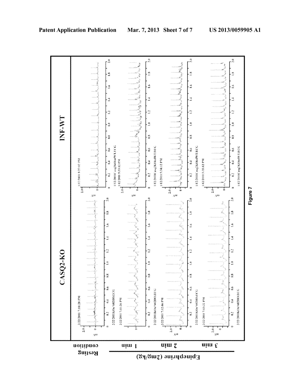 Method of Gene Transfer for the Treatment of Recessive Catecholaminergic     Polymorphic Ventricular Tachycardia (CPVT) - diagram, schematic, and image 08