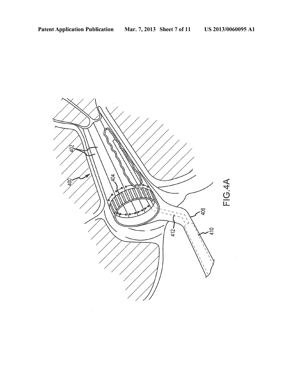 Vaginal Speculum - diagram, schematic, and image 08