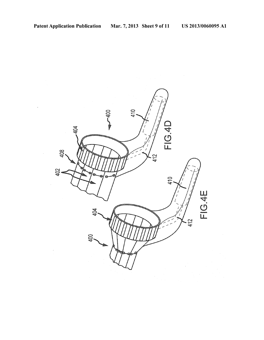 Vaginal Speculum - diagram, schematic, and image 10