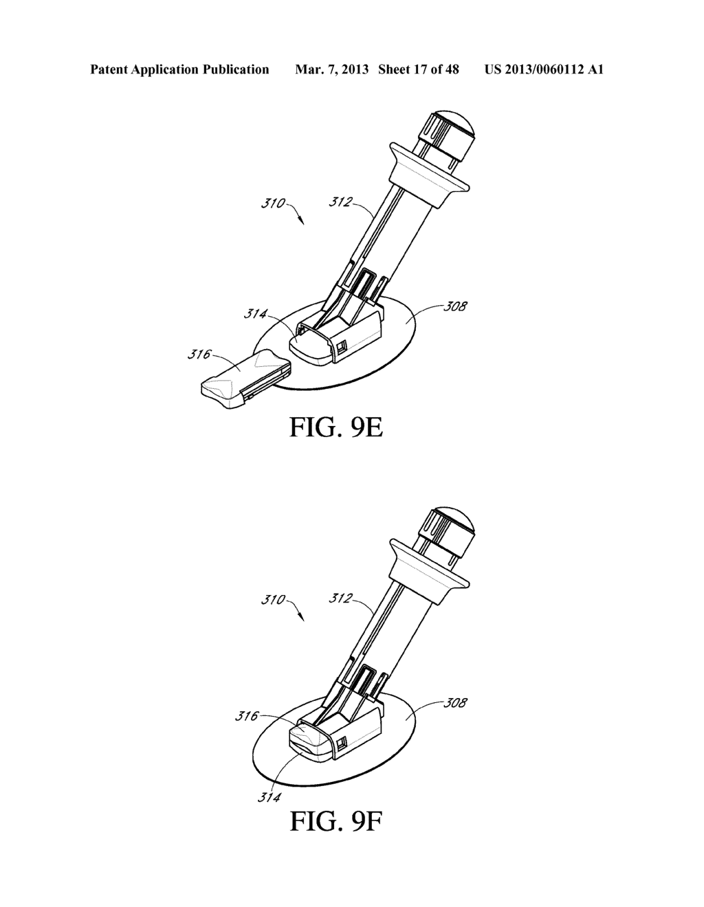 SYSTEM AND METHODS FOR PROCESSING ANALYTE SENSOR DATA FOR SENSOR     CALIBRATION - diagram, schematic, and image 18