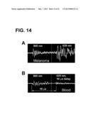 DEVICE AND METHOD FOR IN VIVO FLOW CYTOMETRY USING THE DETECTION OF     PHOTOACOUSTIC WAVES diagram and image