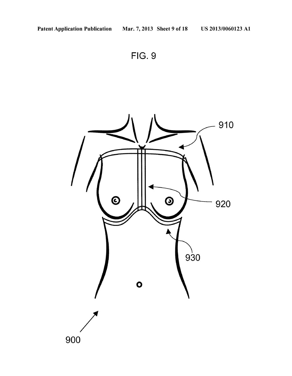 METHOD FOR DETERMINING BREAST VOLUME TO ASSIST MEDICAL PROCEDURE - diagram, schematic, and image 10