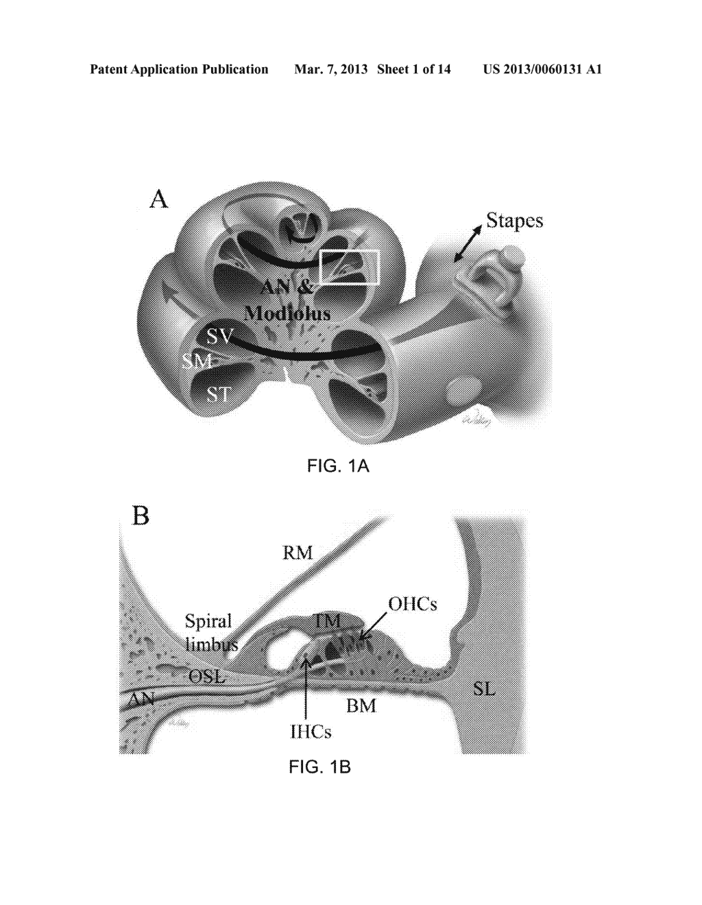 METHOD AND APPARATUS FOR EXAMINING INNER EAR - diagram, schematic, and image 02