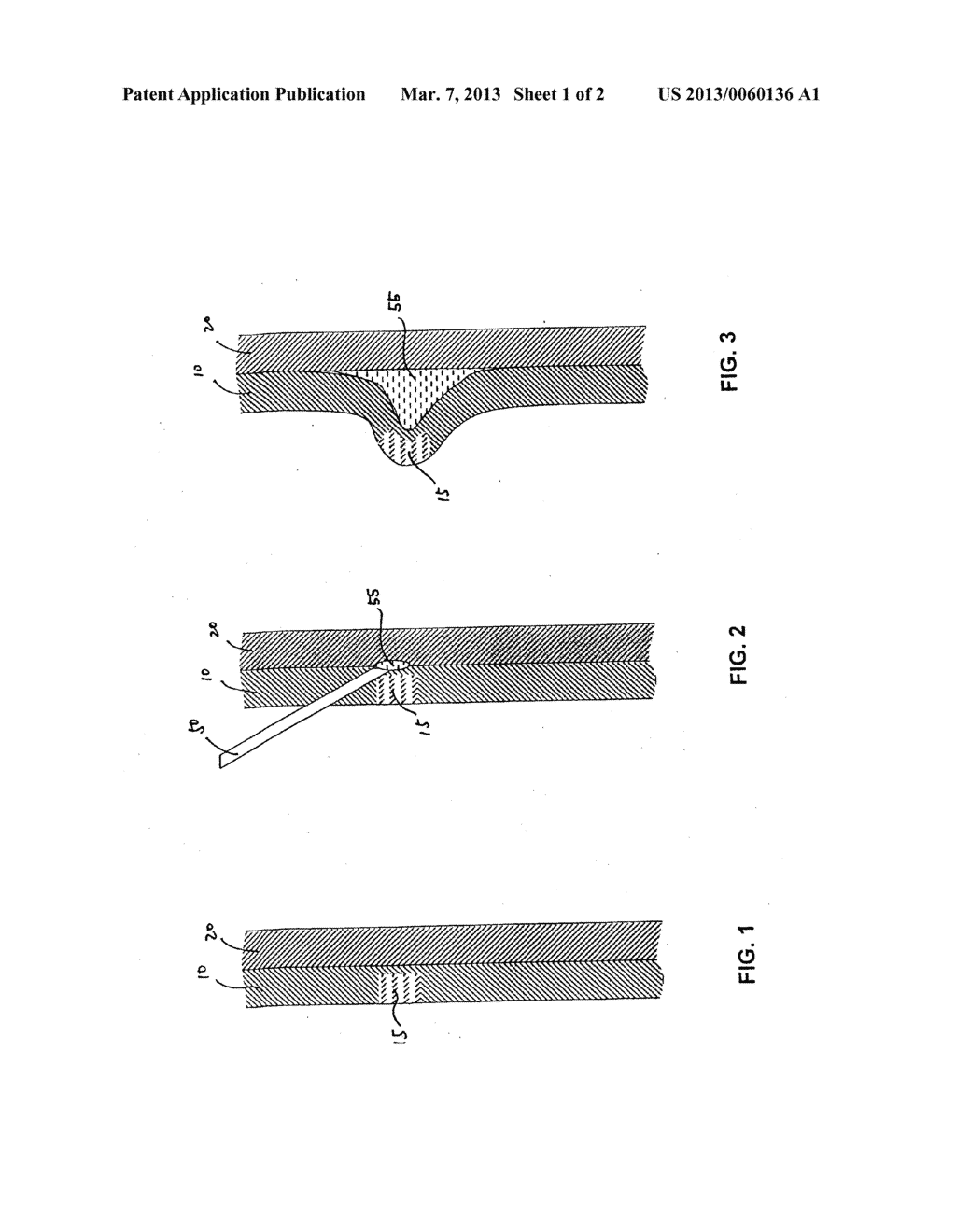 DEVICES AND METHODS FOR AGENT-ASSISTED MEDICAL PROCEDURES - diagram, schematic, and image 02