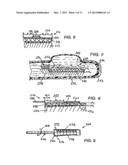 ULTRASONIC TRANSDUCER ASSEMBLY diagram and image