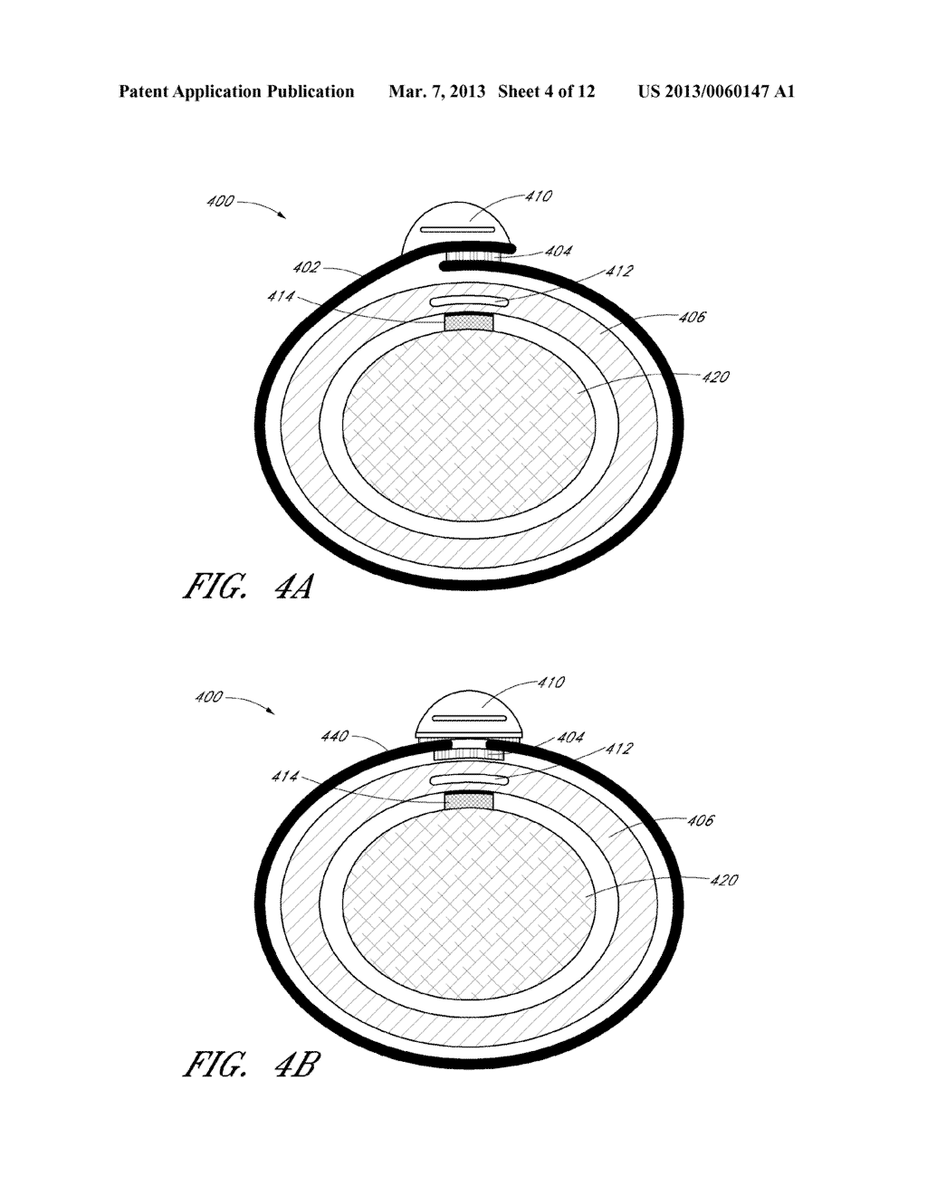 OCCLUSIVE NON-INFLATABLE BLOOD PRESSURE DEVICE - diagram, schematic, and image 05