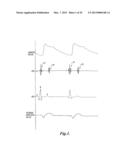 PULSE DETECTION USING PATIENT PHYSIOLOGICAL SIGNALS diagram and image