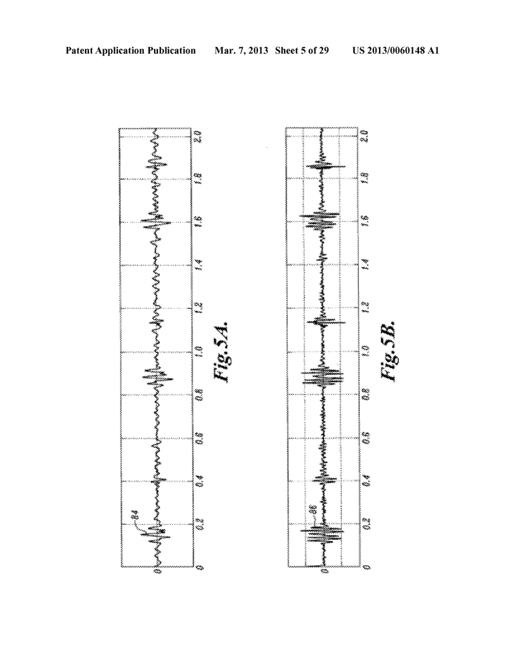 PULSE DETECTION USING PATIENT PHYSIOLOGICAL SIGNALS - diagram, schematic, and image 06