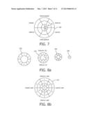 VISUALIZATON OF MYOCARDIAL INFARCT SIZE IN DIAGNOSTIC ECG diagram and image