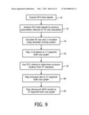 VISUALIZATON OF MYOCARDIAL INFARCT SIZE IN DIAGNOSTIC ECG diagram and image