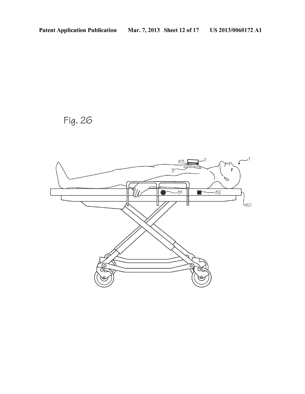 Automated CPR Chest Compression Device with Feedback from a Chest     Compression Monitor - diagram, schematic, and image 13