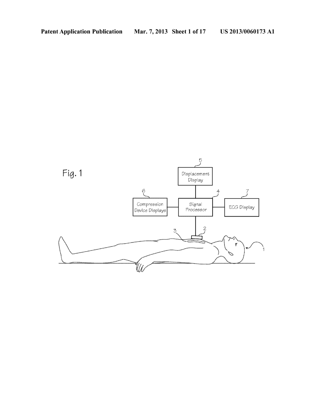 Automated CPR Chest Compression Device with Feedback from a Chest     Compression Monitor - diagram, schematic, and image 02