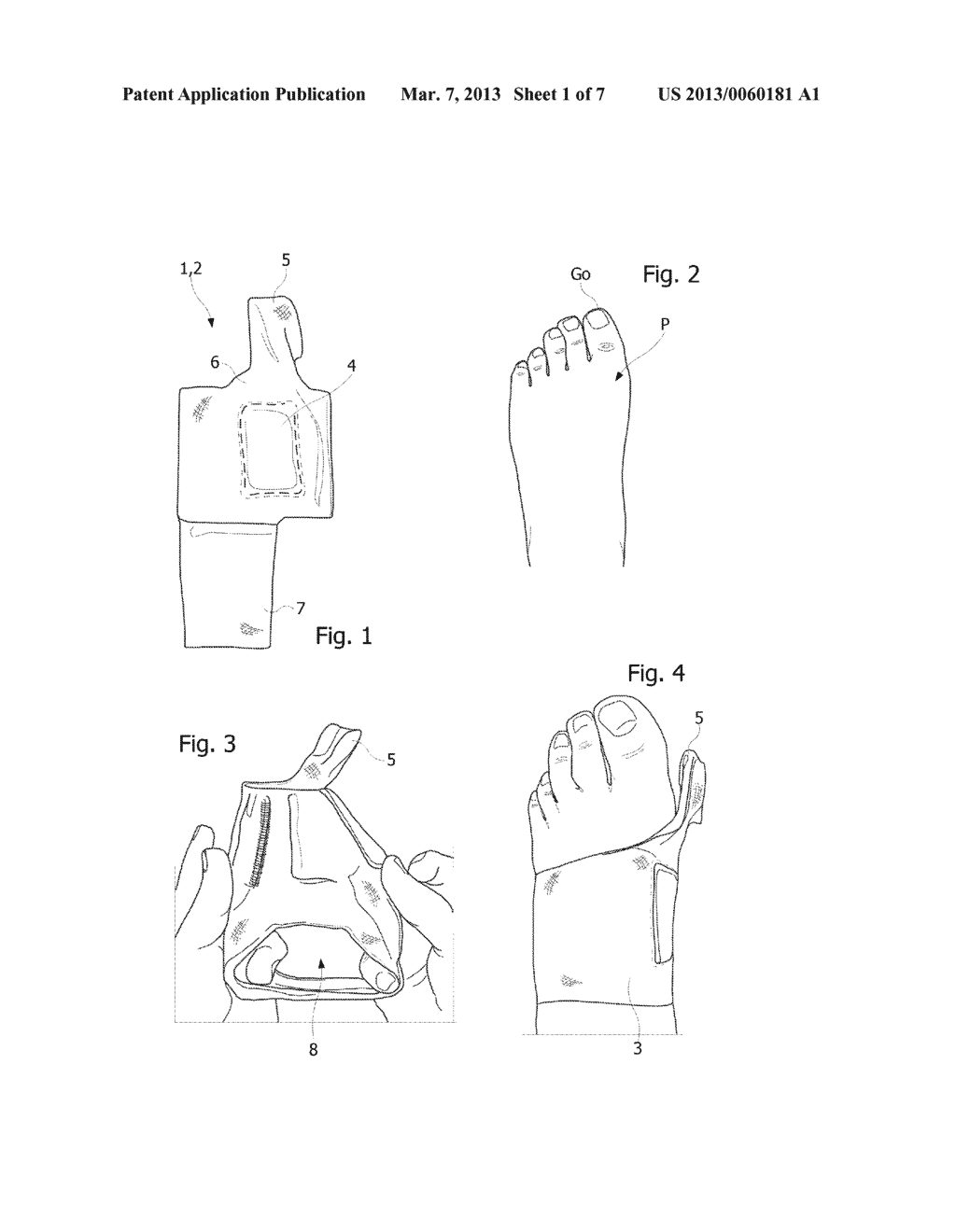 ORTHOPEDIC DEVICE FOR THE MECHANICAL TREATMENT OF HALLUX VALGUS - diagram, schematic, and image 02