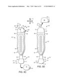 Body Attached Absorbent Article Donning System diagram and image