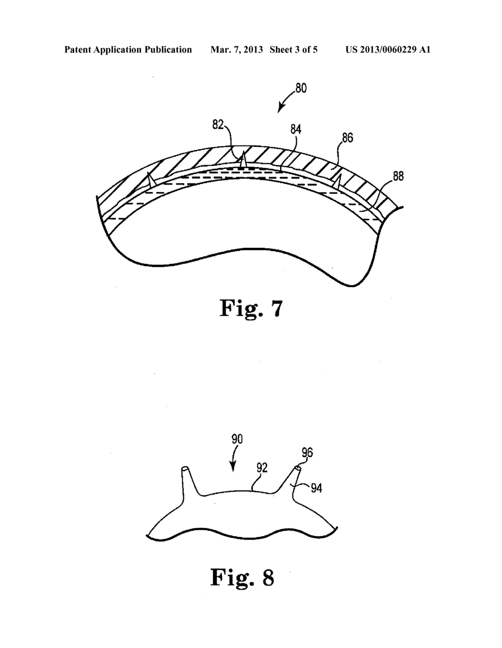 DEVICES, SYSTEMS, AND RELATED METHODS FOR DELIVERY OF FLUID TO TISSUE - diagram, schematic, and image 04