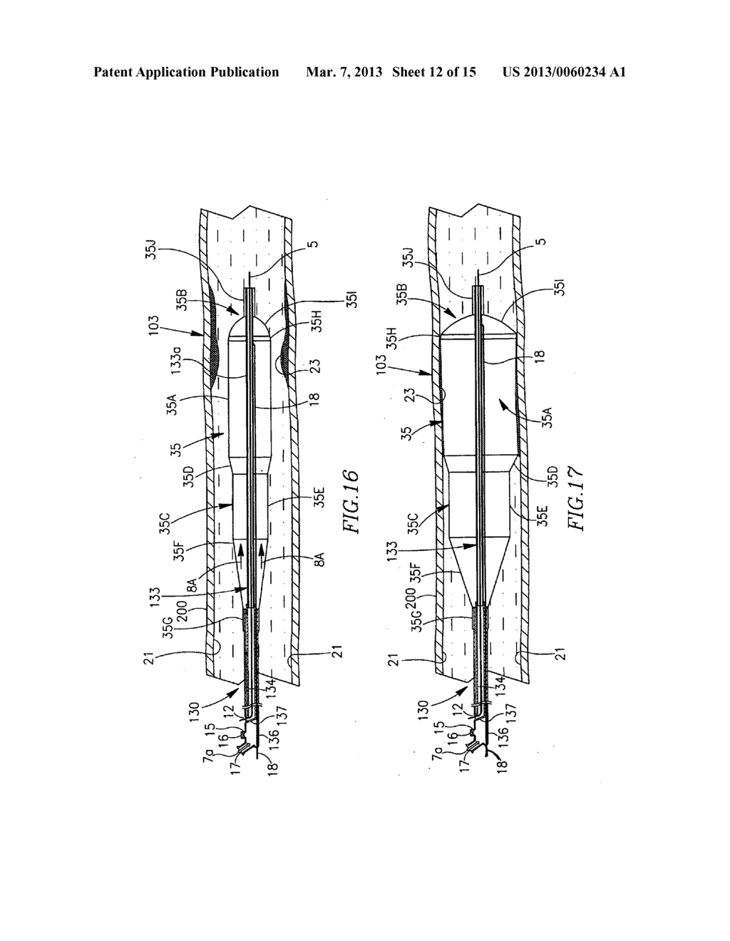 INTUSSUSCEPTING BALLOON CATHETER AND METHODS FOR CONSTRUCTING AND USING     THEREOF - diagram, schematic, and image 13