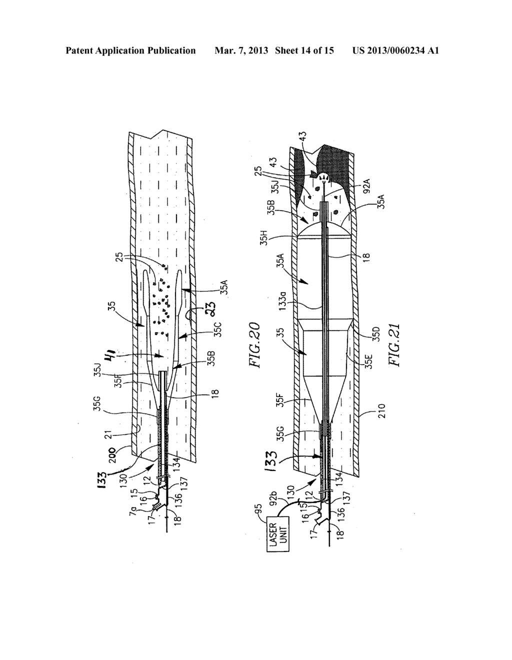 INTUSSUSCEPTING BALLOON CATHETER AND METHODS FOR CONSTRUCTING AND USING     THEREOF - diagram, schematic, and image 15