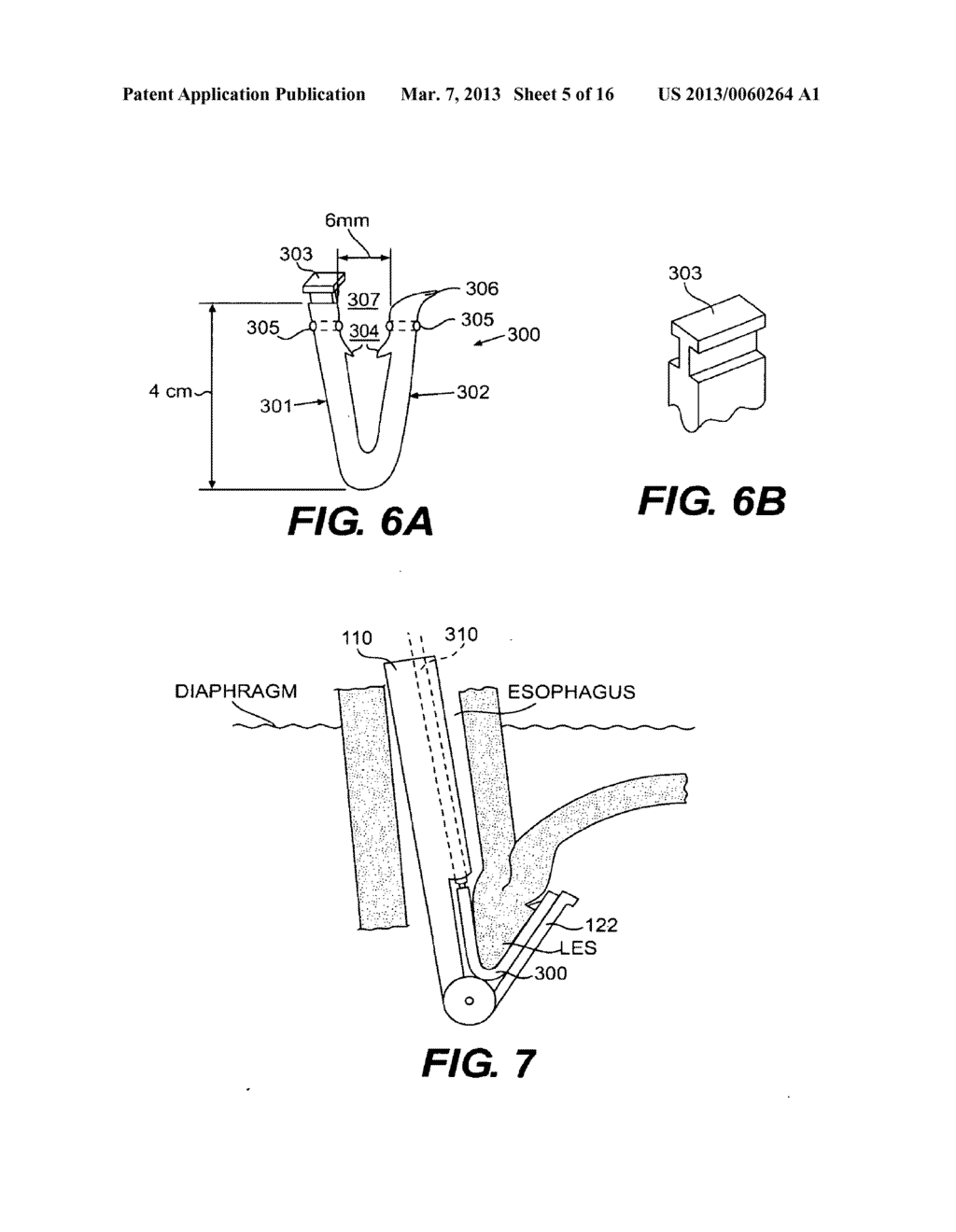 METHODS AND DEVICES FOR FOLDING AND SECURING TISSUE - diagram, schematic, and image 06