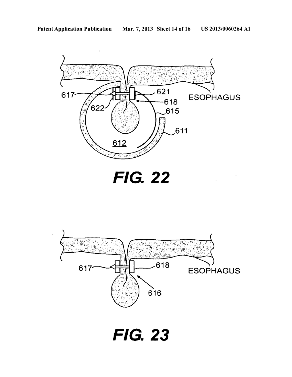 METHODS AND DEVICES FOR FOLDING AND SECURING TISSUE - diagram, schematic, and image 15
