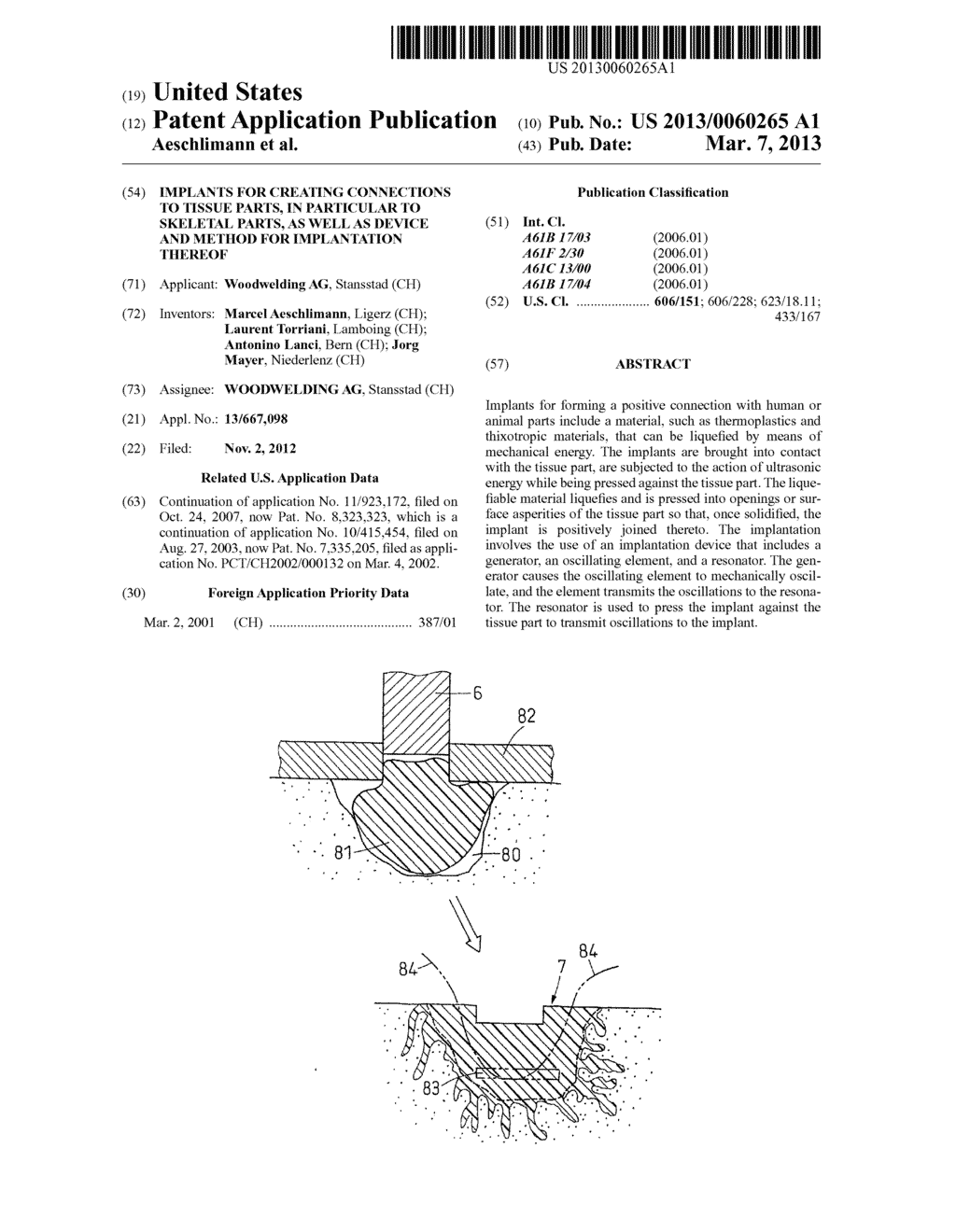 IMPLANTS FOR CREATING CONNECTIONS TO TISSUE PARTS, IN PARTICULAR TO     SKELETAL PARTS, AS WELL AS DEVICE AND METHOD FOR IMPLANTATION THEREOF - diagram, schematic, and image 01