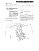 CANNULA TIPS, TISSUE ATTACHMENT RINGS, AND METHODS OF DELIVERING AND USING     THE SAME diagram and image