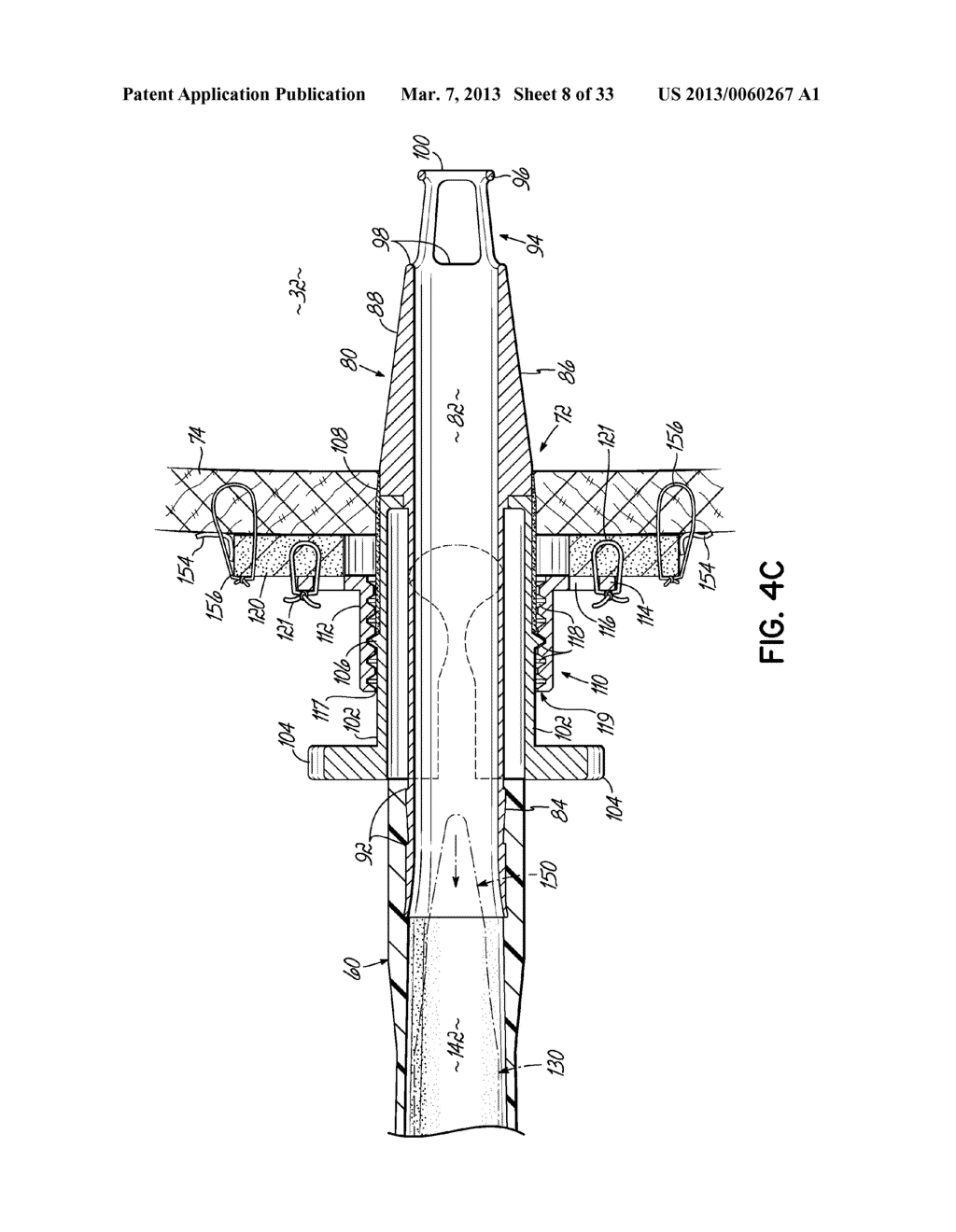 CANNULA TIPS, TISSUE ATTACHMENT RINGS, AND METHODS OF DELIVERING AND USING     THE SAME - diagram, schematic, and image 09