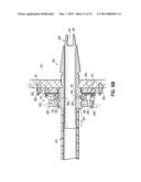 CANNULA TIPS, TISSUE ATTACHMENT RINGS, AND METHODS OF DELIVERING AND USING     THE SAME diagram and image