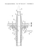 CANNULA TIPS, TISSUE ATTACHMENT RINGS, AND METHODS OF DELIVERING AND USING     THE SAME diagram and image