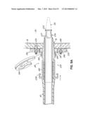 CANNULA TIPS, TISSUE ATTACHMENT RINGS, AND METHODS OF DELIVERING AND USING     THE SAME diagram and image